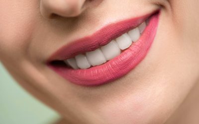 All Your Questions Answered About Teeth Whitening