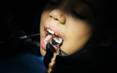 How soon can I get a dental implant after a tooth extraction?