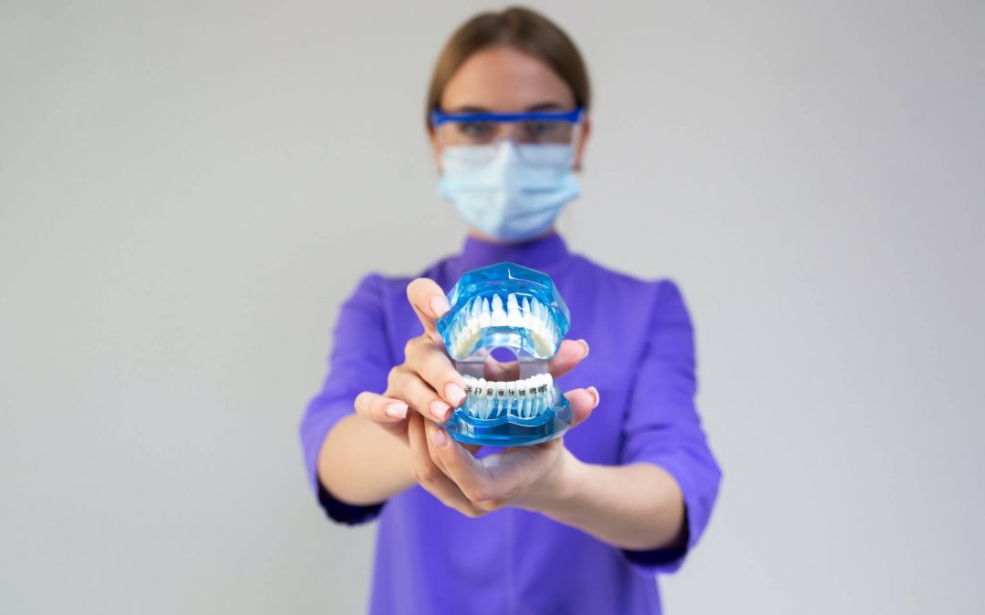 What to Know About the Cost of Dental Implants