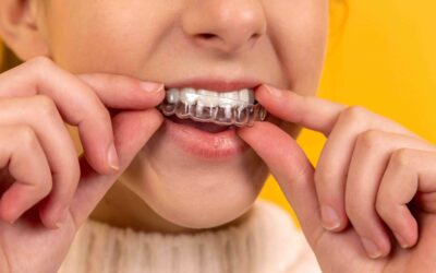 Smile With Confidence: An Invisalign Treatment Guide