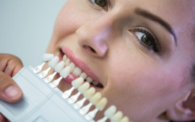 Dental Implants All on 6: Benefits, Cost, and Procedure Explained
