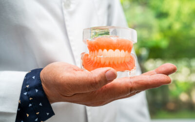 Are You A Suitable Candidate for All-on-6 Dental Implants?