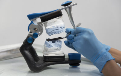 What is the Recovery Process for All on 6 Dental Implants